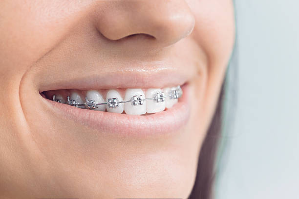 Best Dental Inlays and Onlays  in Fitchburg, MA